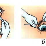 Инородное тело в глазу. помощь при попадании и удаление инородного тела из глаза